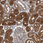 Immunohistochemical staining of human kidney shows strong cytoplasmic positivity in cells in tubules.