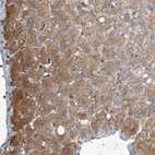 Immunohistochemical staining of human liver shows moderate cytoplasmic positivity in hepatocytes.
