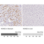Anti-KCNE2 Antibody