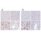 Immunohistochemical staining of human cerebral cortex, liver, stomach and testis using Anti-KCNE2 antibody HPA029706 (A) shows similar protein distribution across tissues to independent antibody HPA051553 (B).