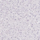 Immunohistochemical staining of human liver shows low expression as expected.