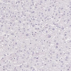Immunohistochemical staining of human liver shows low expression as expected.