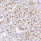 Immunohistochemical staining of human stomach shows high expression.