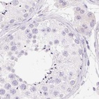 Immunohistochemical staining of human testis using Anti-KCNE2 antibody HPA029706.