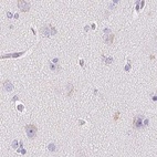 Immunohistochemical staining of human cerebral cortex using Anti-KCNE2 antibody HPA029706.