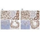 Immunohistochemical staining of human cerebral cortex, kidney, lymph node and testis using Anti-MAP7 antibody HPA029712 (A) shows similar protein distribution across tissues to independent antibody HPA029713 (B).