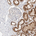 Immunohistochemical staining of human kidney shows strong cytoplasmic positivity in cells in tubules.