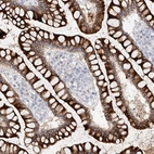 Immunohistochemical staining of human colon shows strong cytoplasmic positivity in glandular cells.