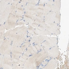 Immunohistochemical staining of human skeletal muscle shows no positivity in myocytes.