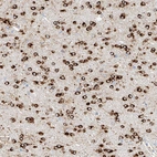 Immunohistochemical staining of human cerebral cortex shows strong cytoplasmic positivity in glial cells.