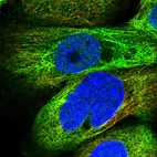 Immunofluorescent staining of human cell line A-431 shows localization to cytosol & microtubules.