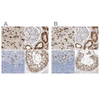 Immunohistochemical staining of human cerebral cortex, kidney, lymph node and testis using Anti-MAP7 antibody HPA029713 (A) shows similar protein distribution across tissues to independent antibody HPA029712 (B).