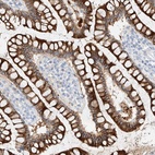 Immunohistochemical staining of human colon shows high expression.