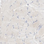 Immunohistochemical staining of human skeletal muscle shows low expression as expected.