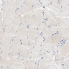 Immunohistochemical staining of human skeletal muscle shows low expression as expected.