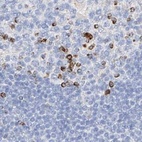 Anti-MAP7 Antibody