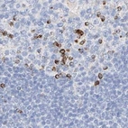 Immunohistochemical staining of human lymph node using Anti-MAP7 antibody HPA029713.