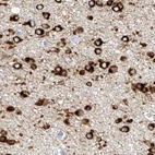 Immunohistochemical staining of human cerebral cortex using Anti-MAP7 antibody HPA029713.