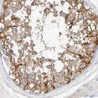 Immunohistochemical staining of human testis using Anti-MAP7 antibody HPA029713.