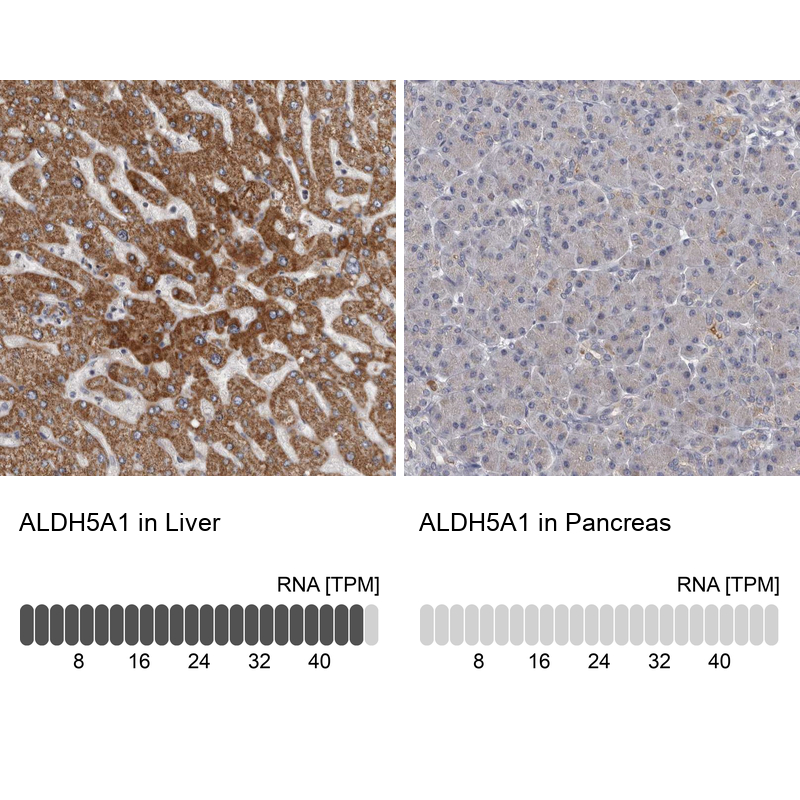 Anti-ALDH5A1 Antibody