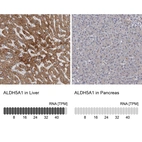 Anti-ALDH5A1 Antibody