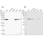 Western blot analysis using Anti-ALDH5A1 antibody HPA029715 (A) shows similar pattern to independent antibody HPA029716 (B).