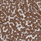 Immunohistochemical staining of human liver shows strong granular cytoplasmic positivity in hepatocytes.