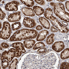 Immunohistochemical staining of human kidney shows strong granular cytoplasmic positivity in cells in tubules.