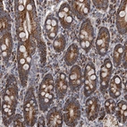 Immunohistochemical staining of human duodenum shows strong granular cytoplasmic positivity in glandular cells.