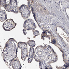 Immunohistochemical staining of human placenta shows negative to very weak granular cytoplasmic positivity in trophoblastic cells.