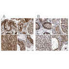 Anti-RAD23B Antibody