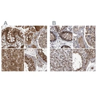 Anti-RAD23B Antibody