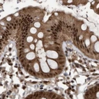 Immunohistochemical staining of human colon using Anti-RAD23B antibody HPA029718.