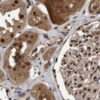 Immunohistochemical staining of human kidney using Anti-RAD23B antibody HPA029718.