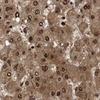 Immunohistochemical staining of human liver using Anti-RAD23B antibody HPA029718.