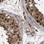Immunohistochemical staining of human testis using Anti-RAD23B antibody HPA029718.