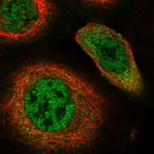 Immunofluorescent staining of human cell line A-431 shows localization to nucleoplasm & cytosol.