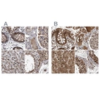 Anti-RAD23B Antibody
