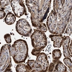 Immunohistochemical staining of human placenta shows nuclear positivity in trophoblastic cells.