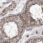 Immunohistochemical staining of human testis shows nuclear positivity in cells in seminiferous ducts and in Leydig cells.