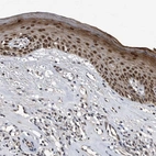 Immunohistochemical staining of human skin shows nuclear positivity in epidermal cells.