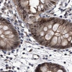 Immunohistochemical staining of human colon using Anti-RAD23B antibody HPA029720.