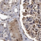Immunohistochemical staining of human kidney using Anti-RAD23B antibody HPA029720.