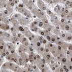 Immunohistochemical staining of human liver using Anti-RAD23B antibody HPA029720.