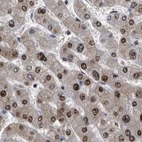 Immunohistochemical staining of human liver using Anti-RAD23B antibody HPA029720.