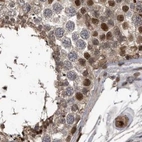 Immunohistochemical staining of human testis using Anti-RAD23B antibody HPA029720.