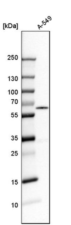 Anti-RAD23B Antibody