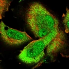 Immunofluorescent staining of human cell line U-251 MG shows localization to nucleoplasm & cytosol.
