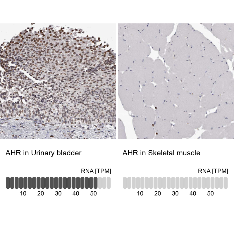 Anti-AHR Antibody