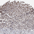Immunohistochemical staining of human urinary bladder shows strong nuclear positivity in urothelial cells.